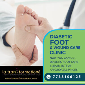 Diabetic foot Treatment in Mumbai