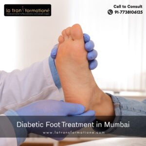 Diabetic foot Treatment Mumbai