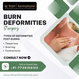 Burn Deformities Surgery in Mumbai