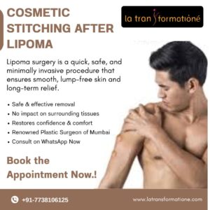COSMETIC STITCHING AFTER LIPOMA